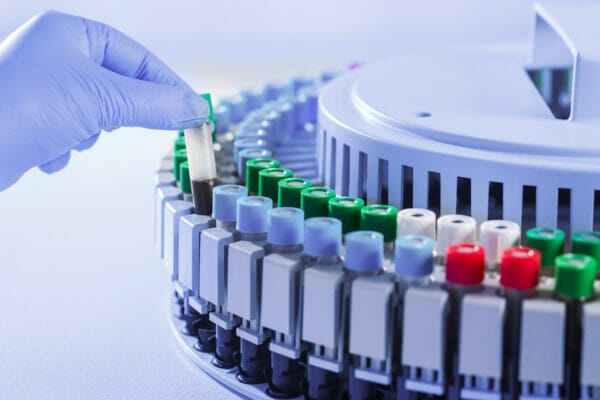 Blood grouping Reagents - solutions from Una Health