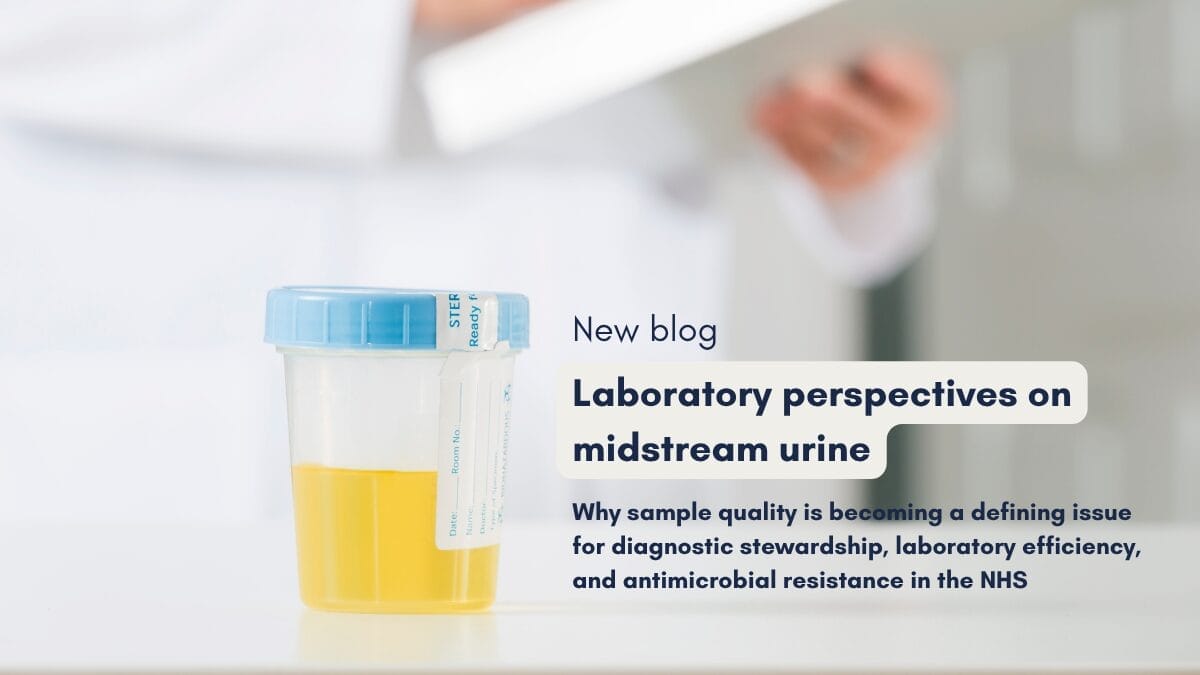 Image of an urine sample in a microbiology lab