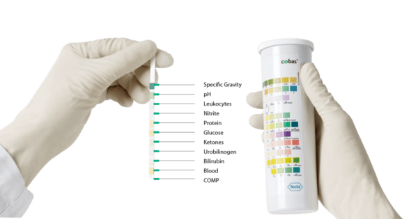 Roche Combur-10 urine test strips from Una health