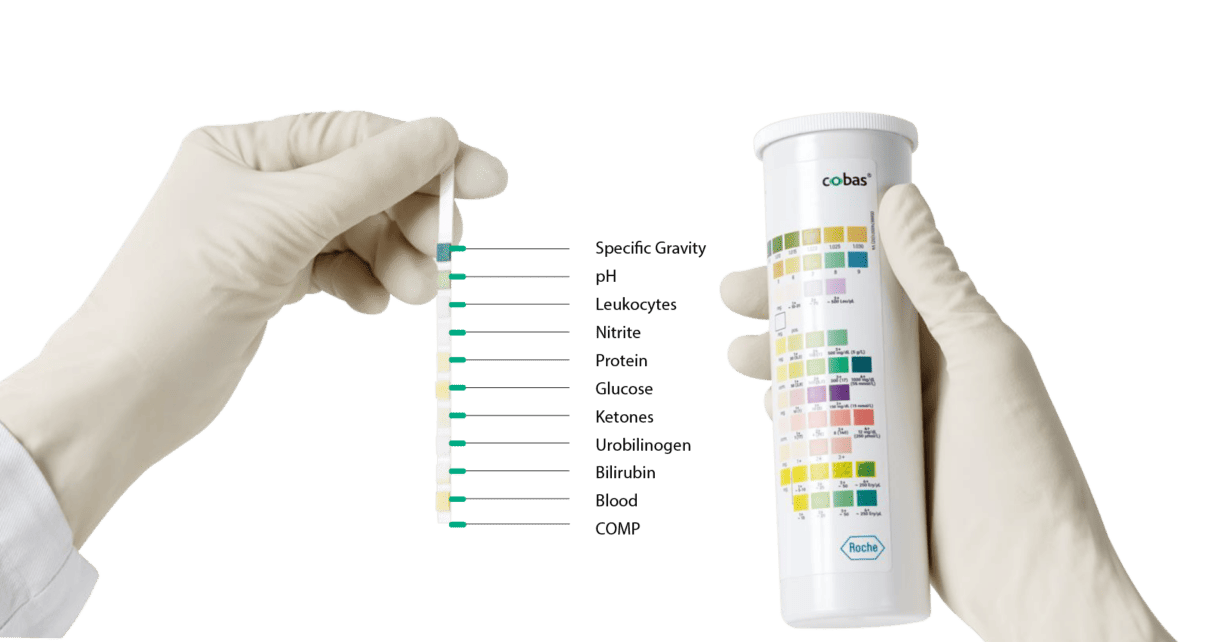Roche Combur-10 urine test strips from Una health