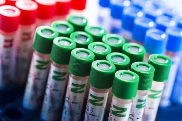 Haematology Reagents from Una Health